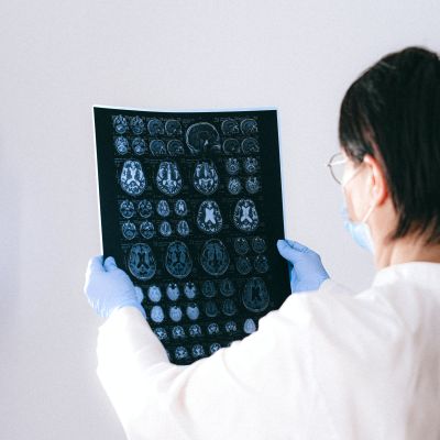 Magnetresonanztomographie (MRT)